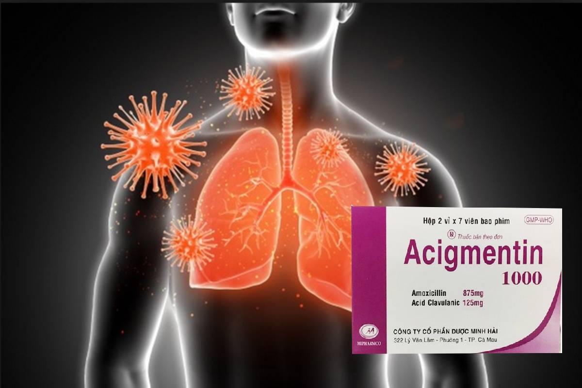 Acigmentin 1000 điều trị nhiễm khuẩn
