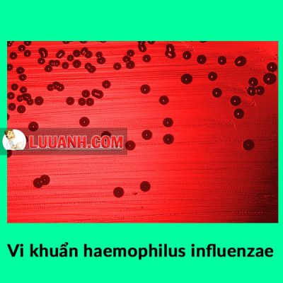 Thuốc Cefuroxime có tác dụng mạnh trên vi khuẩn H.influenzae
