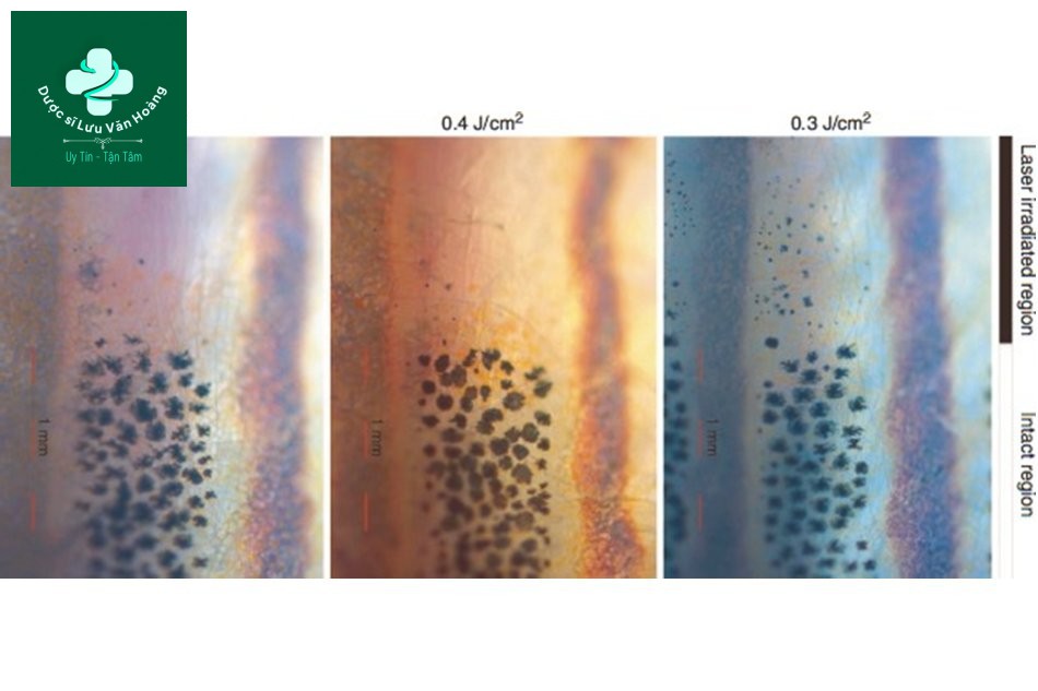 Những thay đổi ở các melanosome trong tế bào melanophore trong sọc đen của cá ngựa vằn sau 5 ngày chiếu laser Q-Switched Nd: YAG. 