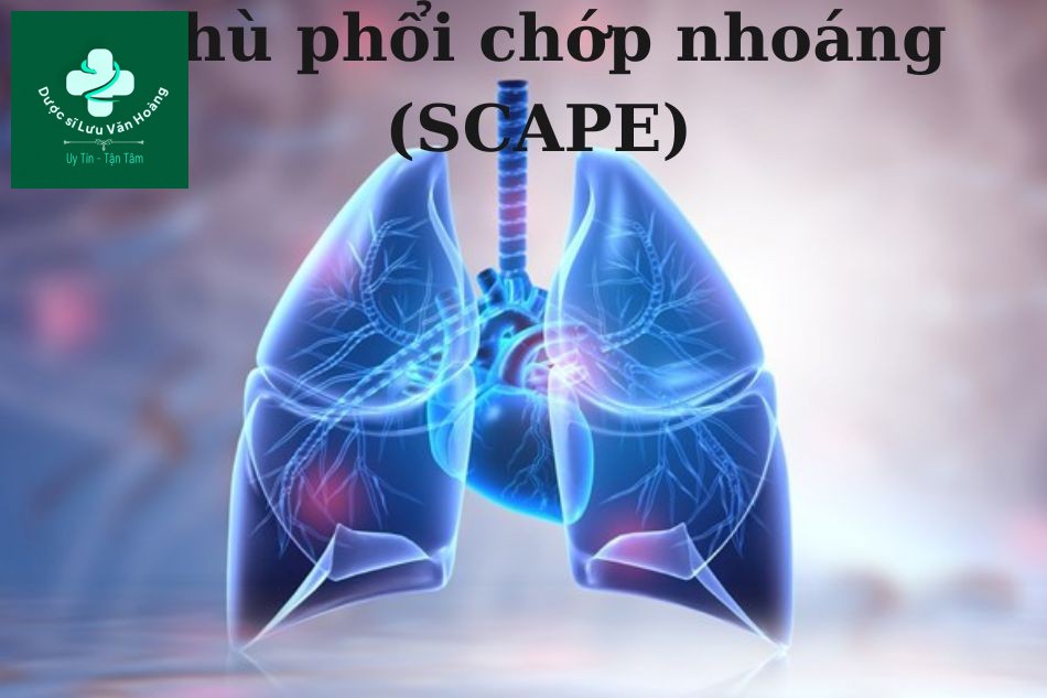 Phù phổi chớp nhoáng (SCAPE)