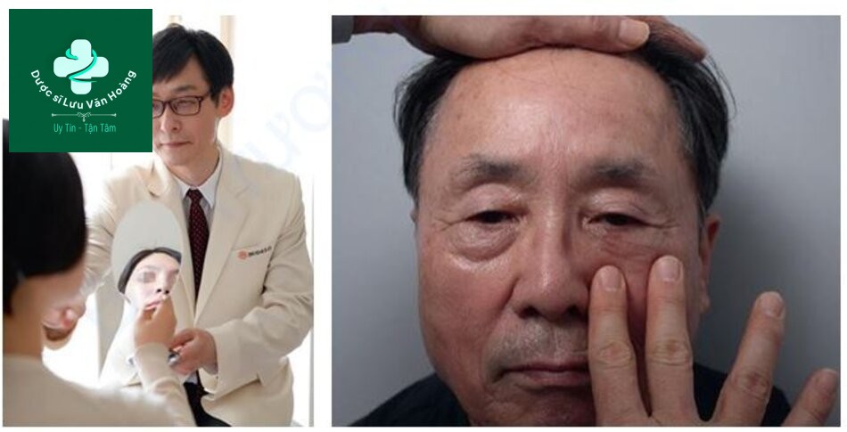 Hình 1.1 (a) Tư vấn qua gương, (b) Một bệnh nhân 72 tuổi với bọng mắt lồi và tear trough được cho thấy kết quả mô phỏng sau khi tiêm chất làm đầy thông qua tư vấn qua gương