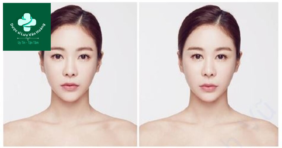  Hình 1.9 Sự mất cân đối của các vị trí tương đối giữa các đặc điểm trên khuôn mặt riêng lẻ có thể làm giảm sức hấp dẫn trên khuôn mặt