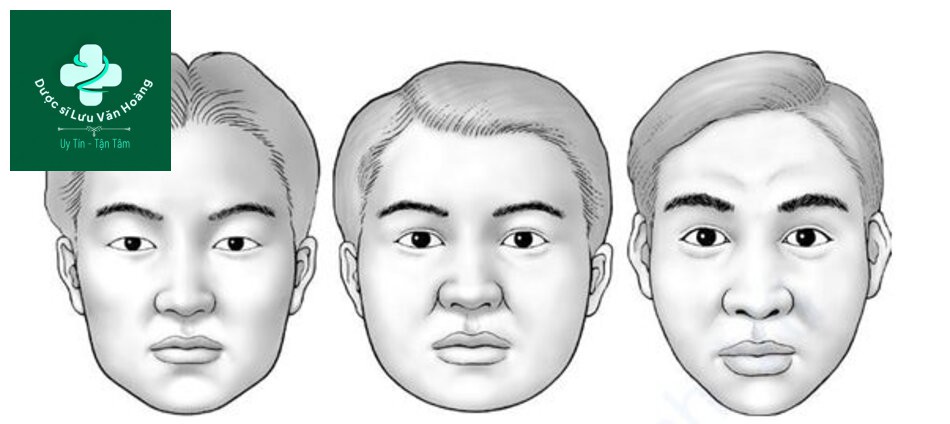 Hình 1.16 Hình thái khuôn mặt của người châu Á gồm các kiểu khuôn mặt phía bắc, trung và nam (từ trái sang phải)