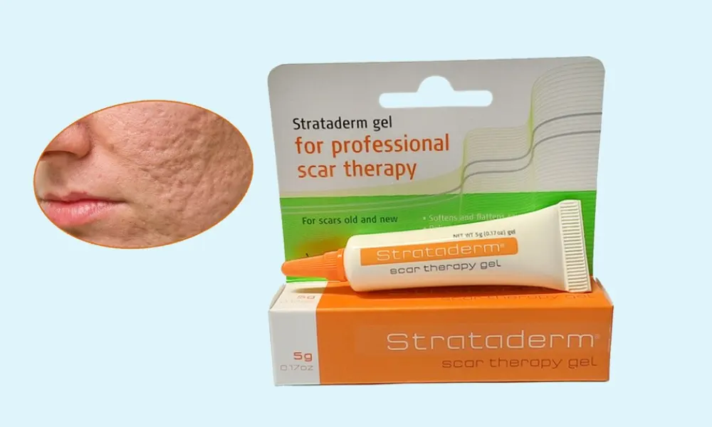 Thuốc trị sẹo lõm an toàn, hiệu quả Strataderm