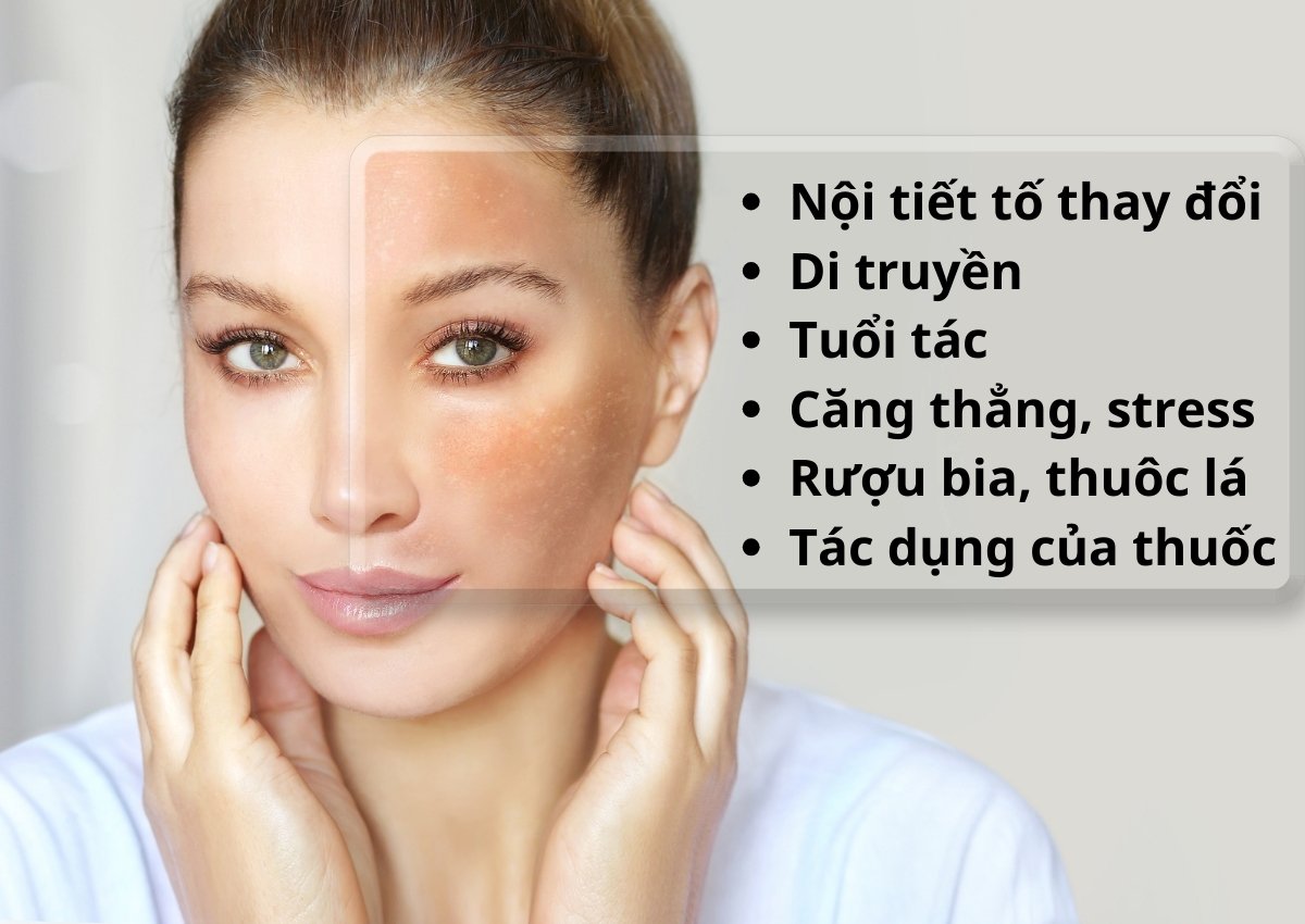 Thuốc trị nám 