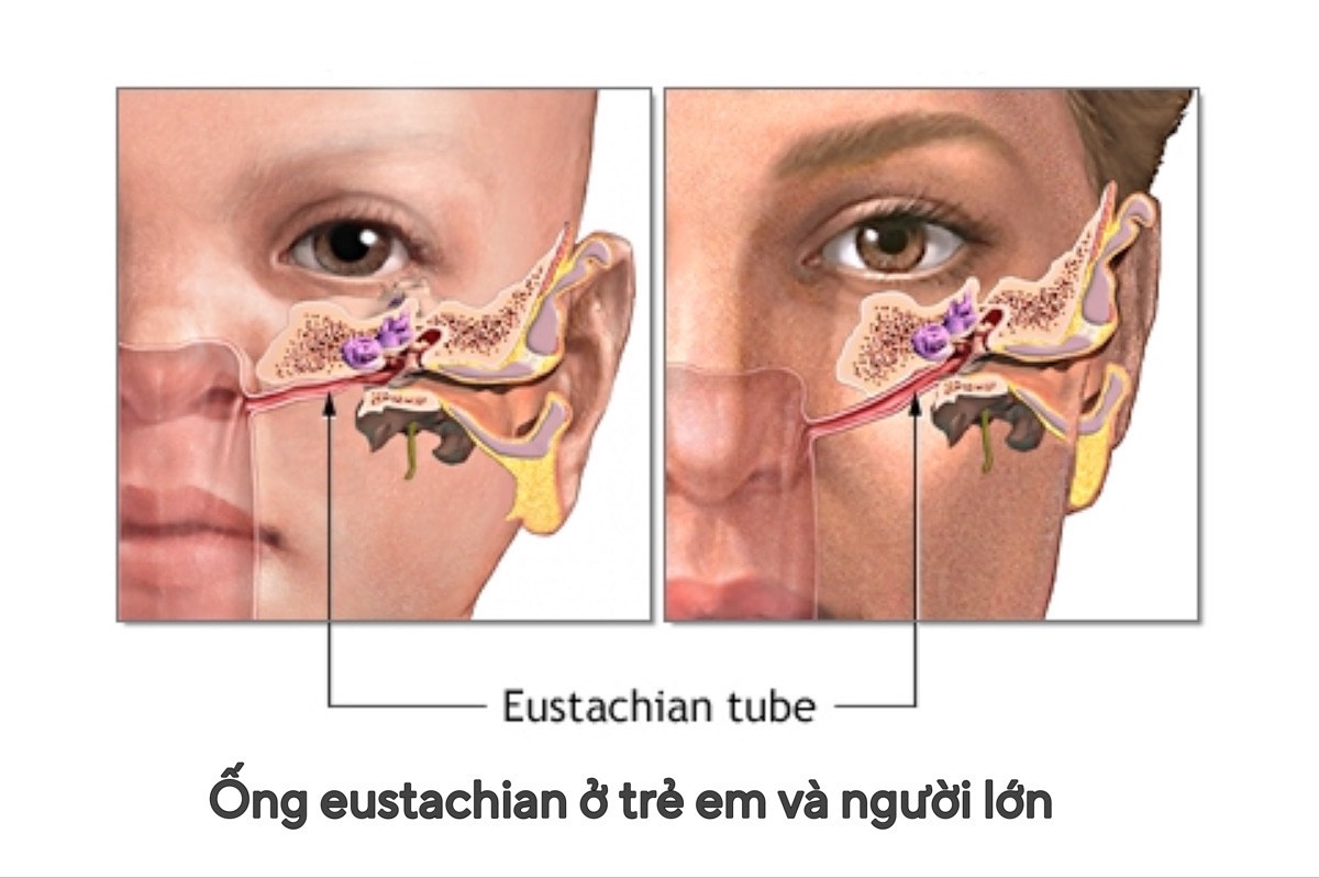 Ống Eustachian ở trẻ em và người lớn