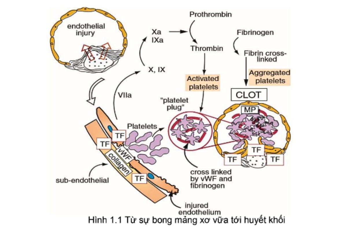 Hình 1.1 Từ sự bong mảng xơ vữa tới huyết khối