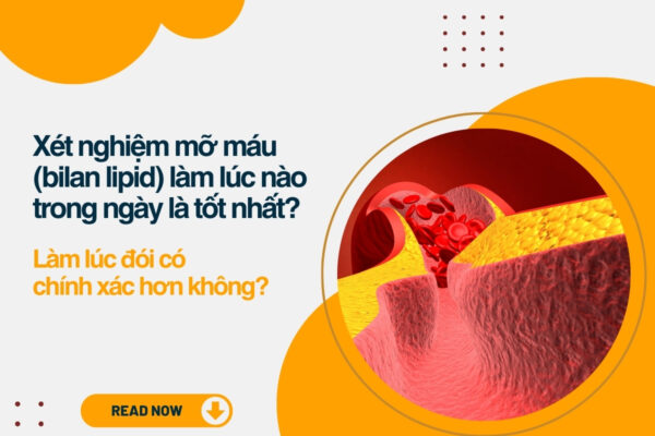 Xét nghiệm mỡ máu (bilan lipid) làm lúc nào trong ngày là tốt nhất? Làm lúc đói có chính xác hơn không?