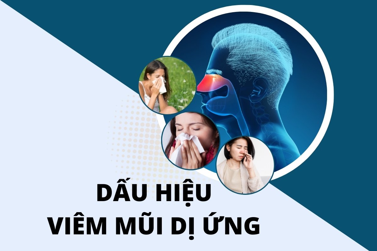 Làm sao để biết có bị viêm mũi dị ứng hay không? 5 dấu hiệu cần chú ý