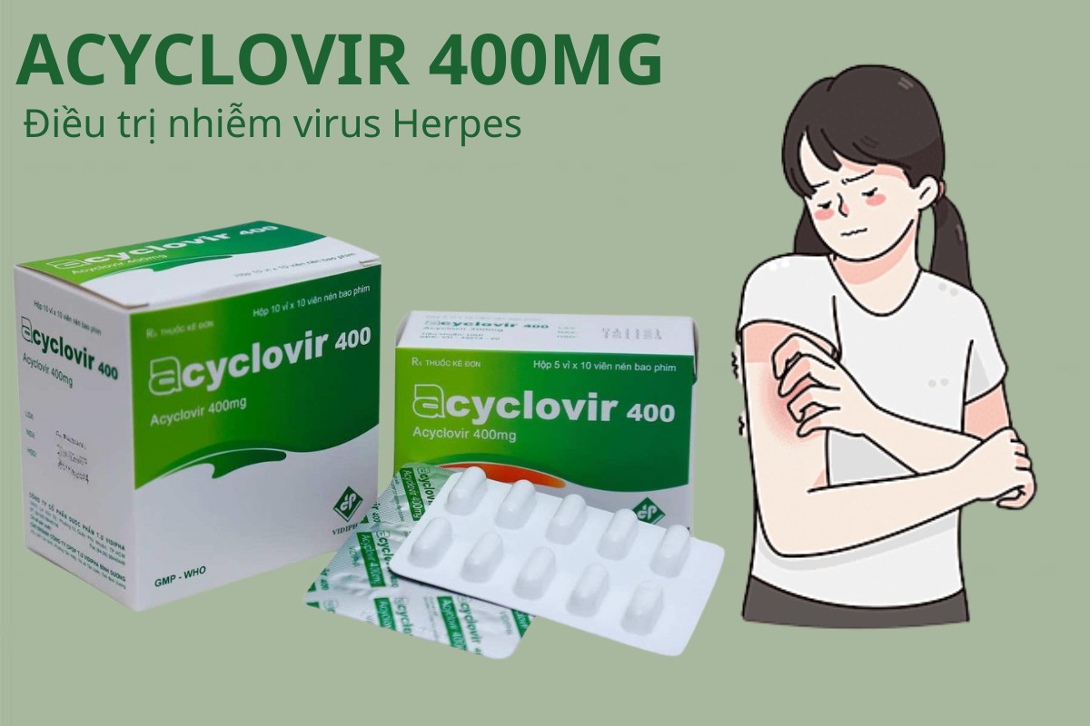 Acyclovir 400 Vidipha 8 Acyclovir 400 Vidipha điều tri nhiễm virus Herpes