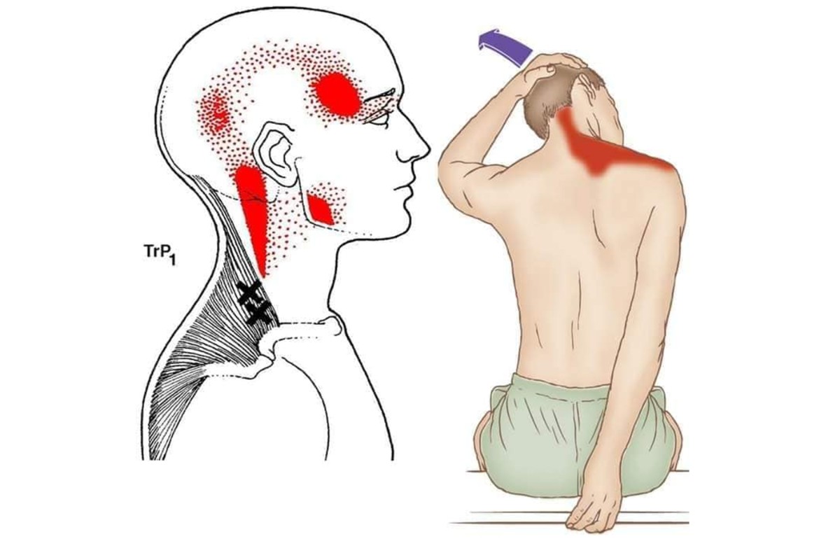 5 bài tập thể dục chữa đau vai gáy hiệu quả nhanh 12 Động tác co duỗi cơ 2 vai