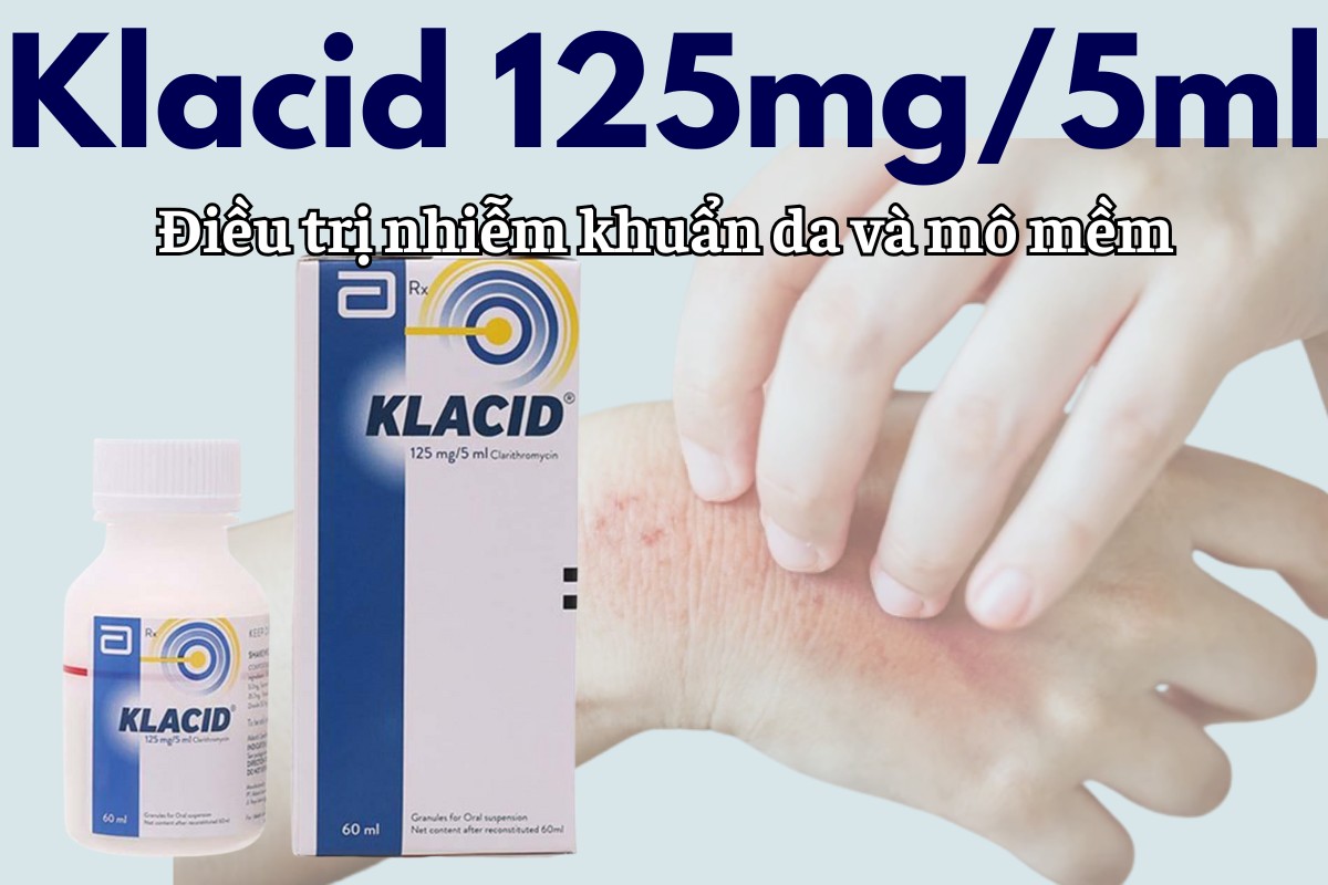 Klacid 125mg/5ml 14 Klacid 125mg/5ml điều trị nhiễm khuẩn da và mô mềm