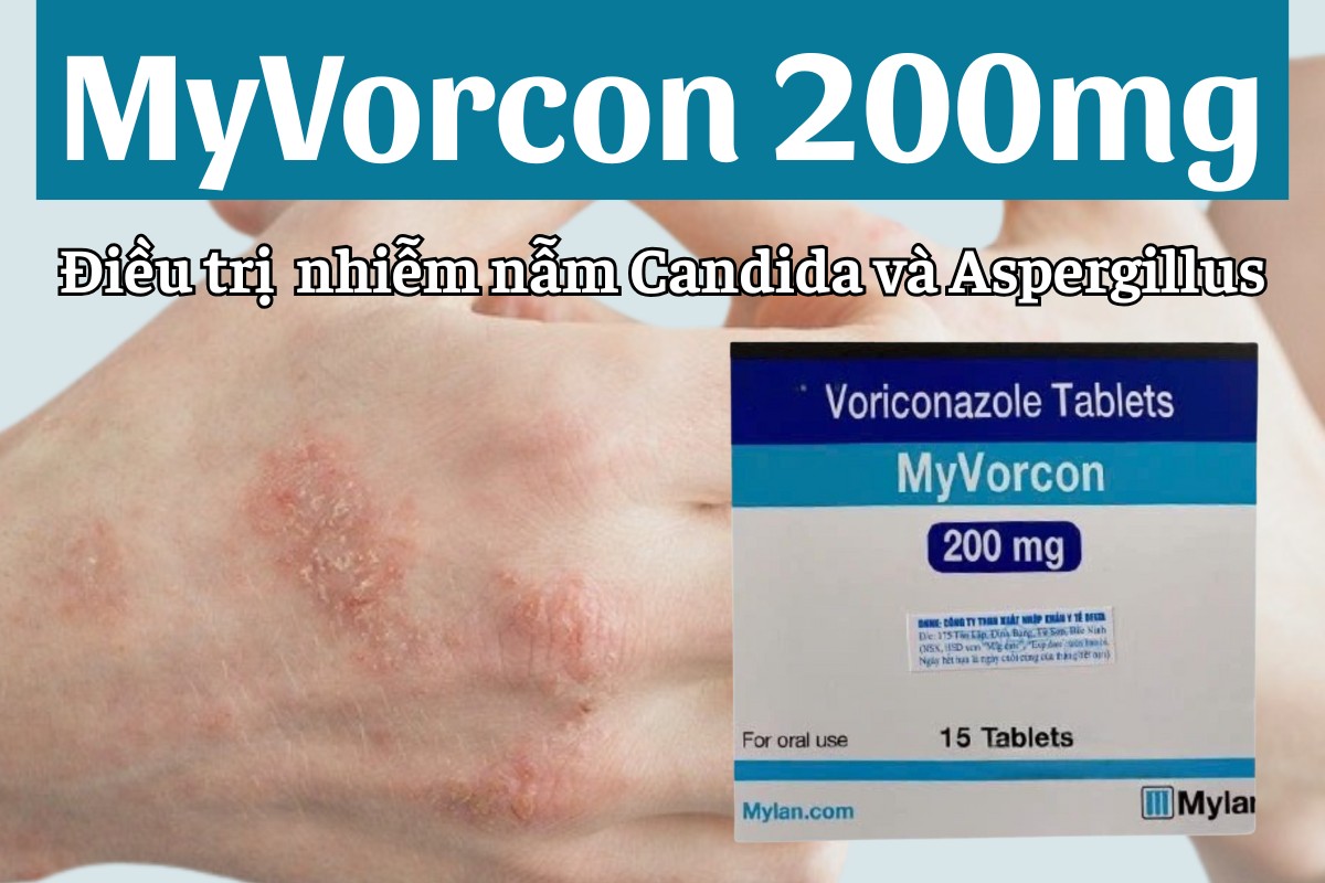 MyVorcon 200mg 5 MyVorcon 200mg điều trị nhiễm nấm Candida và nấm Aspergillus