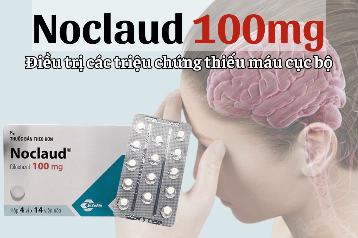 Noclaud 100mg điều trị các triệu chứng thiếu máu cục bộ