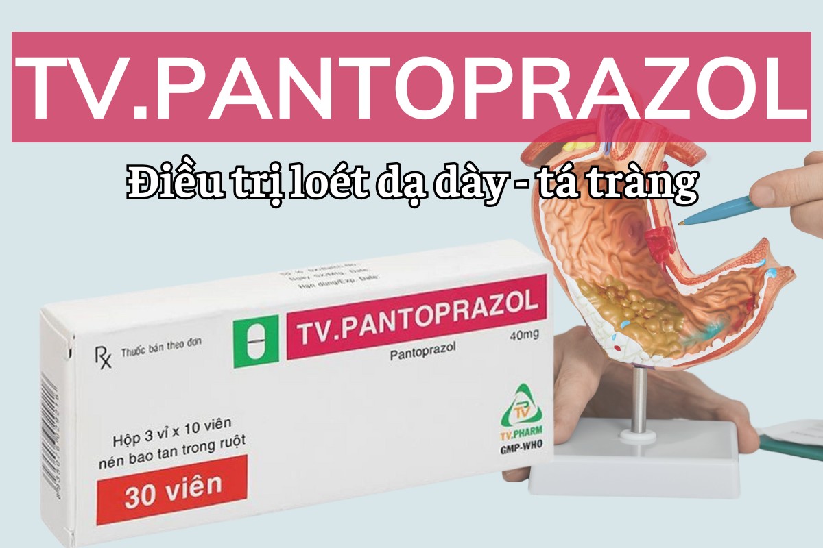 TV. Pantoprazol 12 TV. Pantoprazol điều trị loét dạ dày - tá tràng