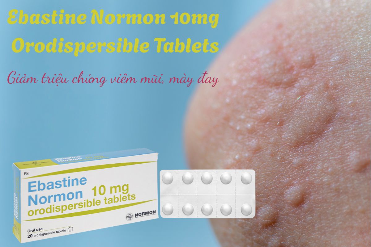 Ebastine Normon 10mg Orodispersible Tablets 18 Ebastine Normon 10mg Orodispersible Tablets