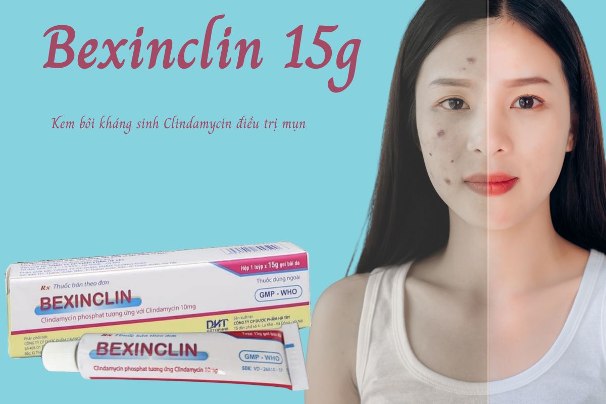 Bexinclin 15g 11 Bexinclin 15g