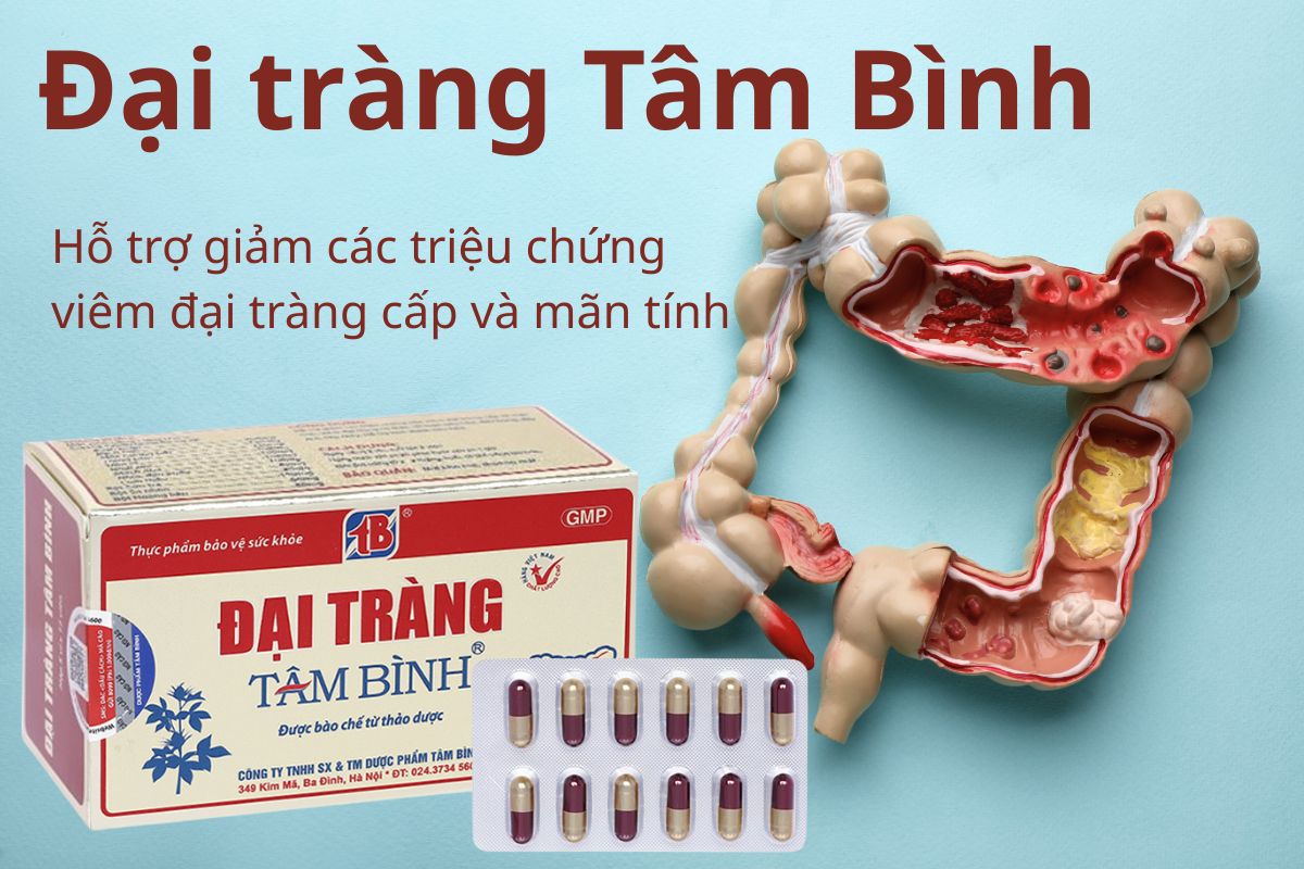 Đại tràng Tâm Bình 16 Đại tràng Tâm Bình