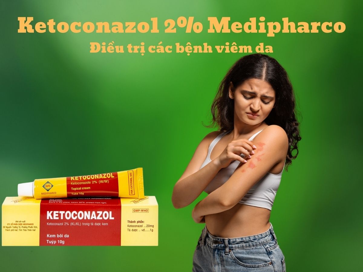 Thuốc Ketoconazol 2% Medipharco có tác dụng trị các bệnh nấm da và niêm mạc