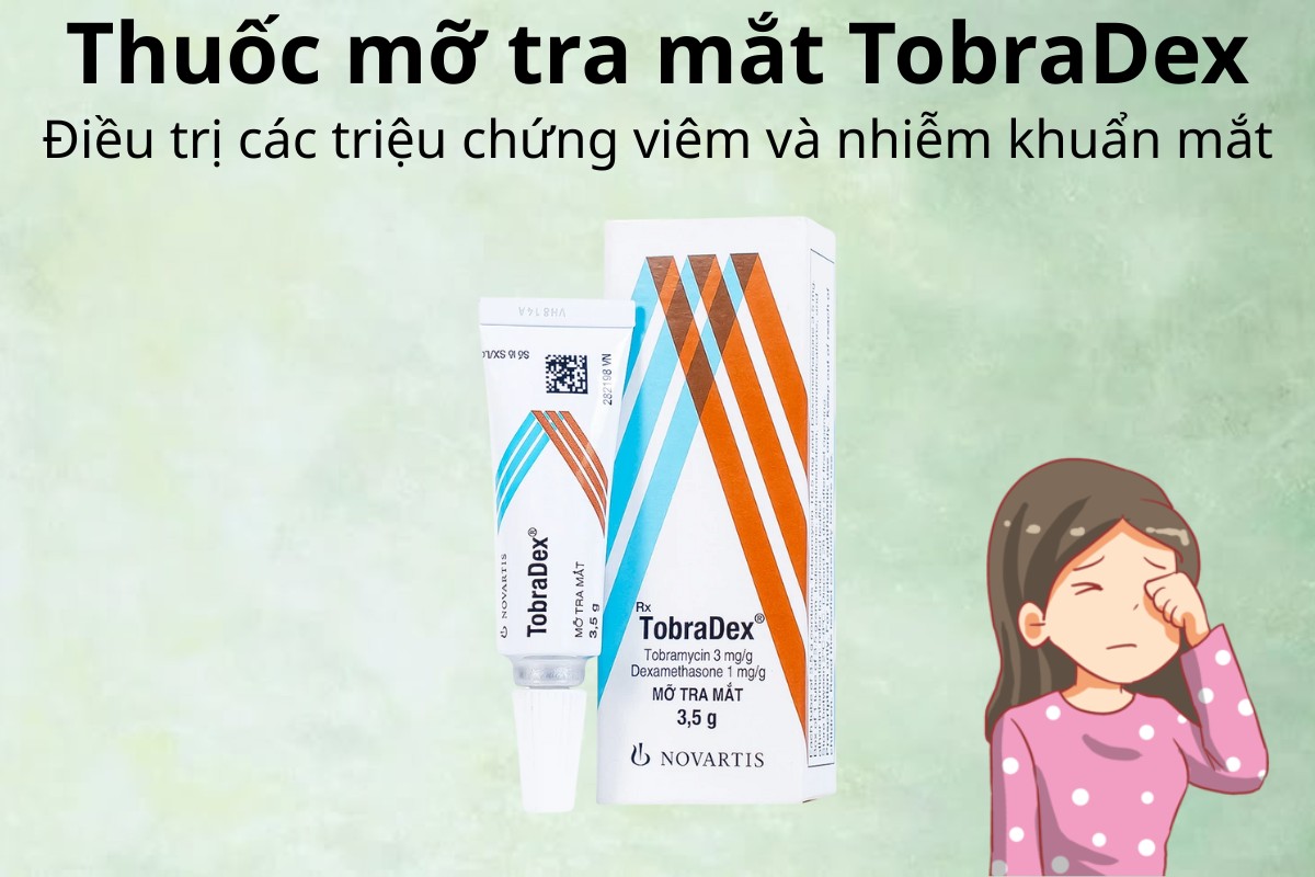 Thuốc mỡ tra mắt TobraDex điều trị triệu chứng viêm và nhiễm khuẩn mắt