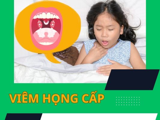 Viêm họng cấp