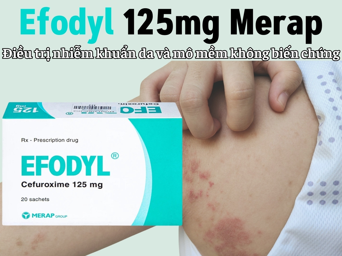 Efodyl 125mg Merap điều trị nhiễm khuẩn da và mô mềm không biến chứng