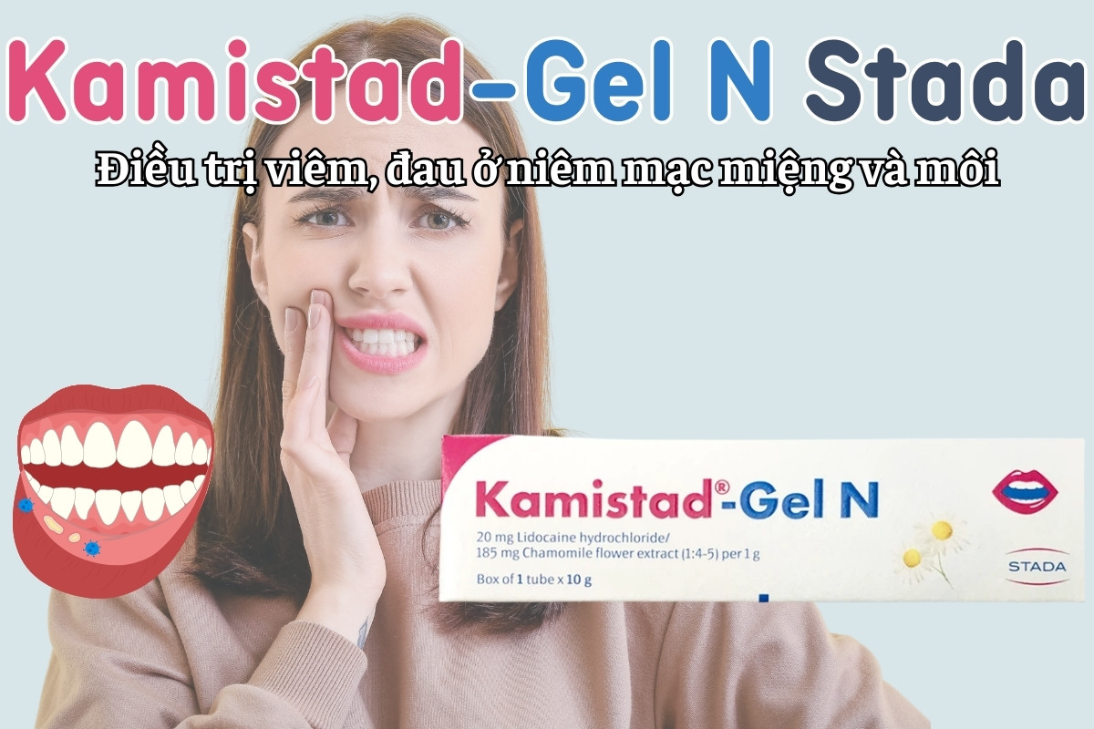 Kamistad-Gel N Stada điều trị viêm, đau niêm mạc miệng và môi