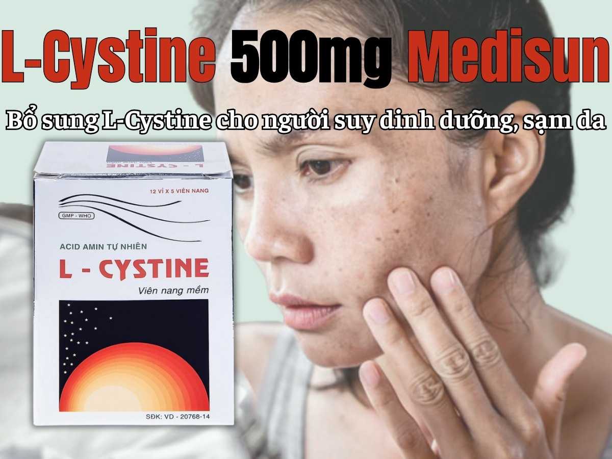 L-Cystine 500mg Medisun 12 L-Cystine 500mg Medisun bổ sung cho người suy dinh dưỡng, kém hấp thu, sạm da