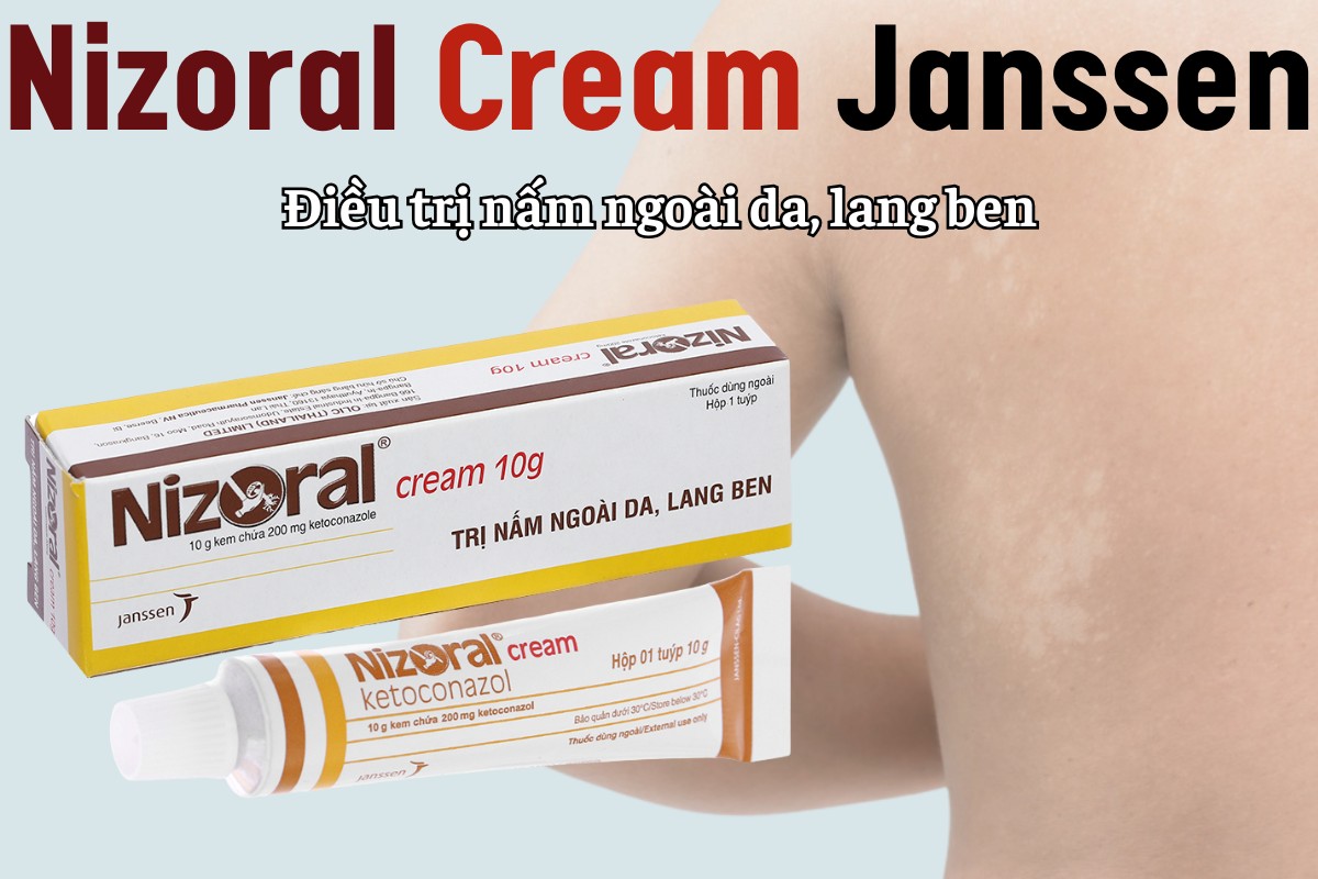 Nizoral Cream Janssen điều trị nấm ngoài da, lang ben