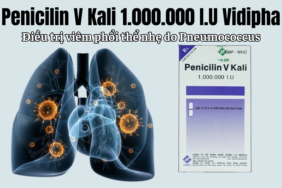 Penicilin V Kali 1.000.000 I.U Vidipha điều trị viêm phổi thể nhẹ do Pneumococcus