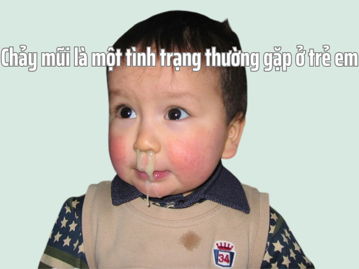 Chảy mũi là một tình trạng thường gặp ở trẻ nhỏ