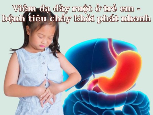 Viêm dạ dày ruột cấp được định nghĩa là một bệnh tiêu chảy khởi phát nhanh, có thể có hoặc không kém theo buồn nôn, nôn, sốt hoặc đau bụng.