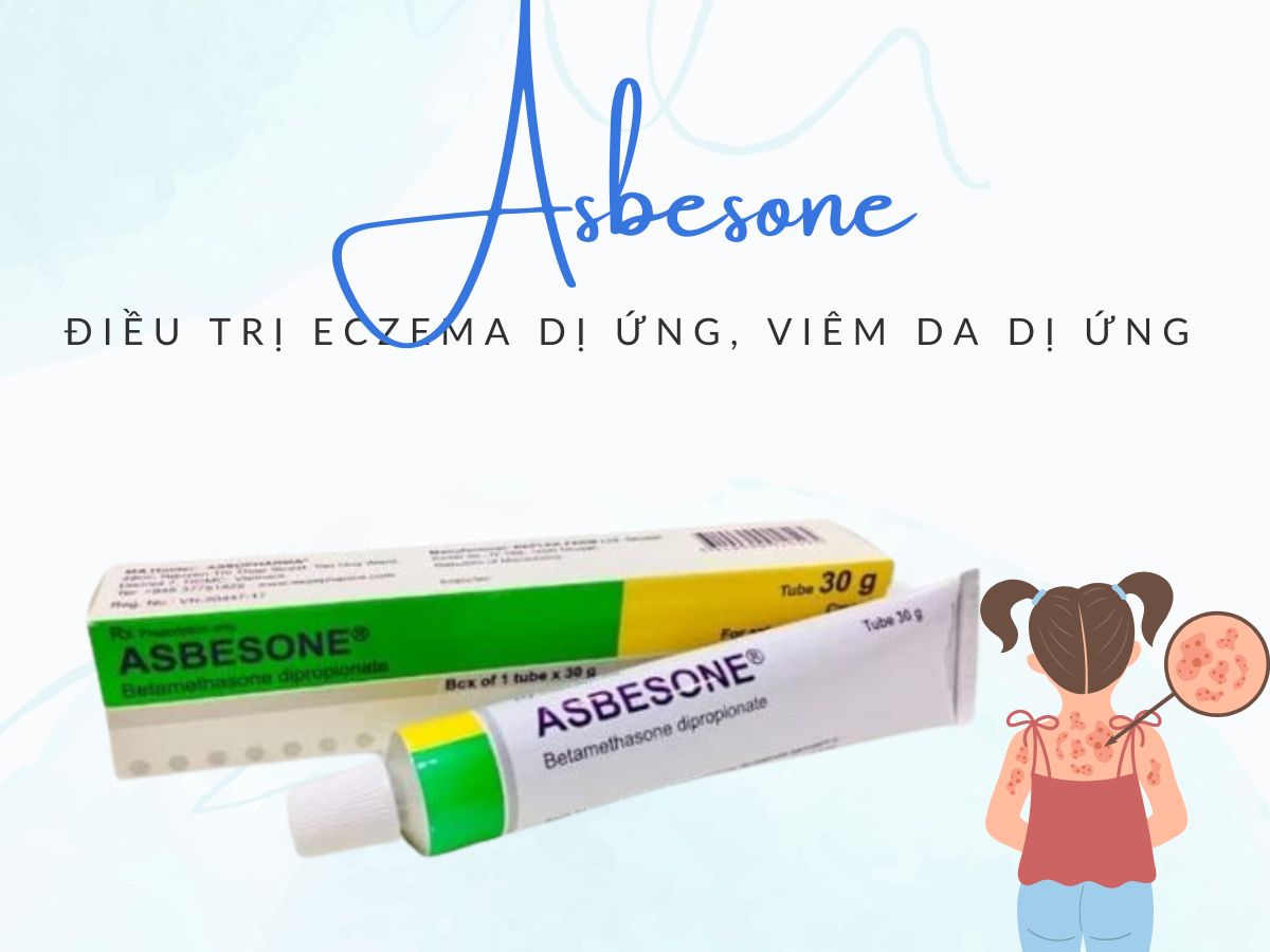 Asbesone 14 Thuốc Asbesone điều trị eczema dị ứng, lupus ban đỏ
