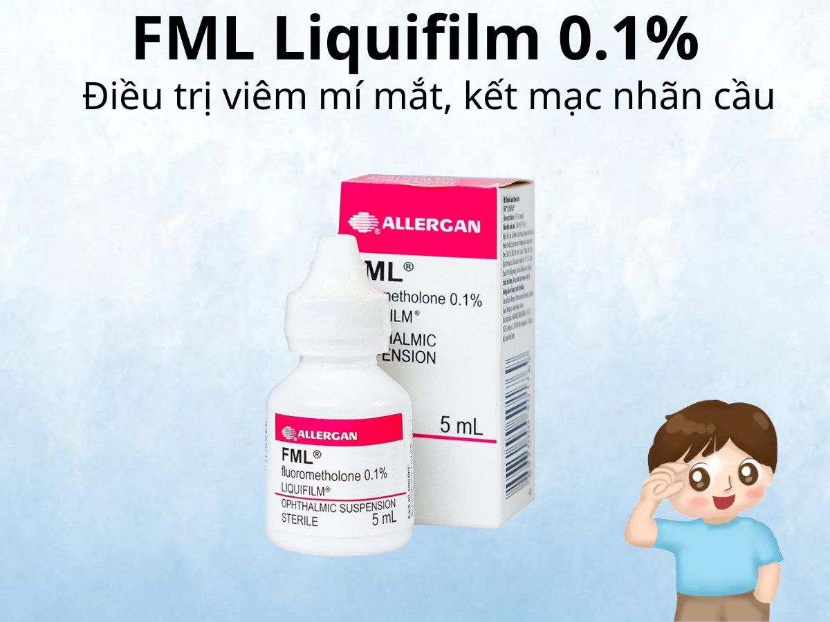 FML Liquifilm 0.1% điều trị viêm mí mắt, kết mạc nhãn cầu