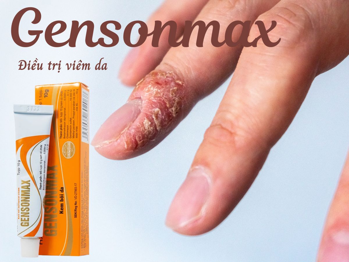 Gensonmax