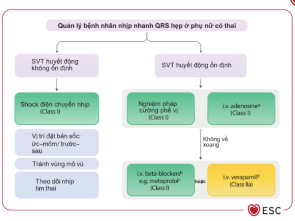 Khuyến cáo ESC 2025 về quản lý bệnh lý tim mạch ở sản phụ : cập nhật và thay đổi so với ESC 2018 54 Hình 14: Quản lý bệnh nhân nhịp nhanh QRS hẹp ở phụ nữ có thai