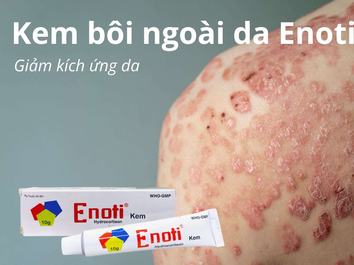 Kem bôi ngoài da Enoti