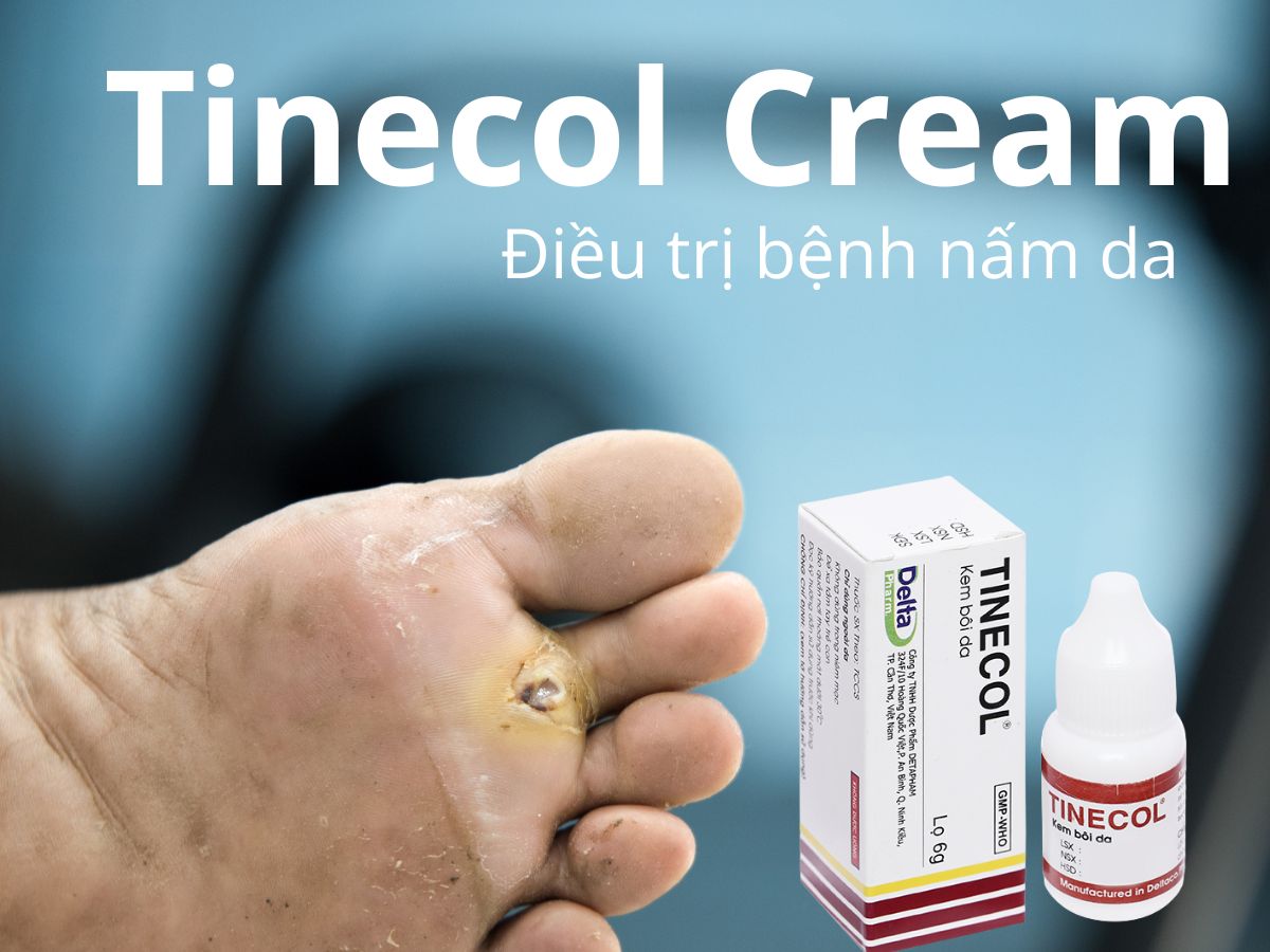 Tinecol Cream