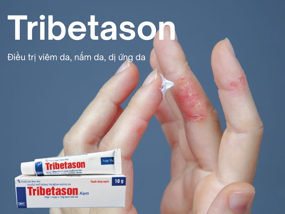 Tribetason