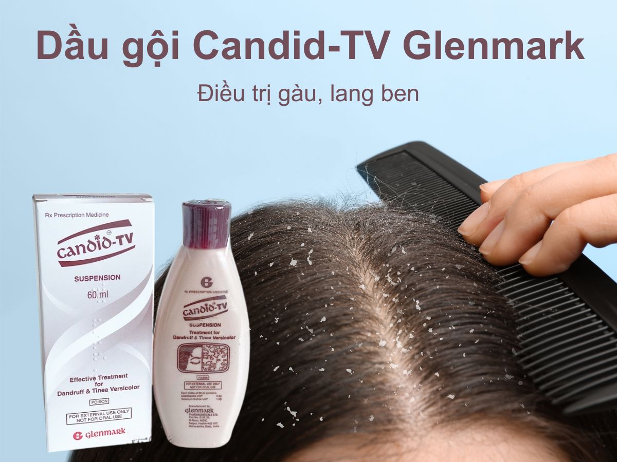Dầu gội Candid-TV Glenmark 12 Dầu gội Candid-TV Glenmark