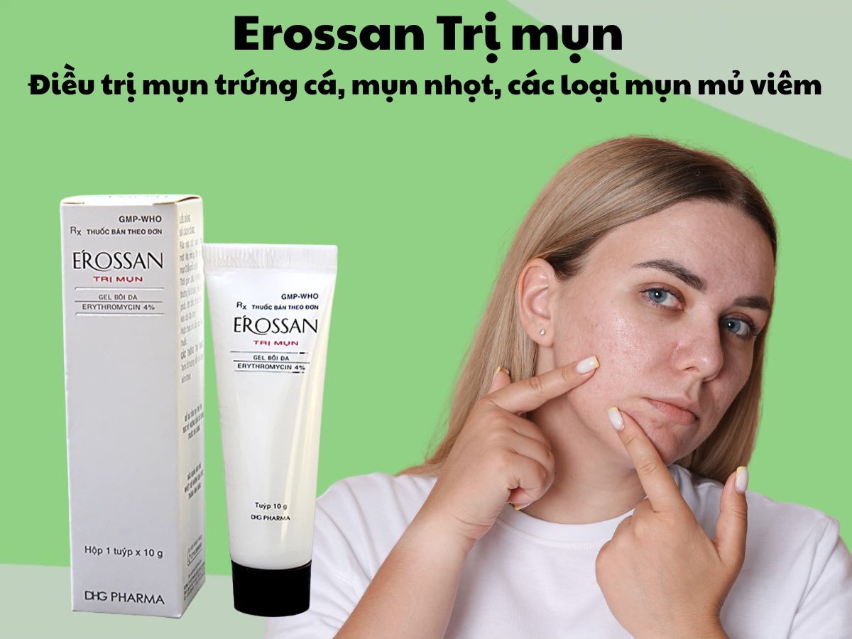 Erossan Trị Mụn 9 Thuốc Erossan Trị Mụn điều trị mụn trứng cá, mụn nhọt, mụn viêm