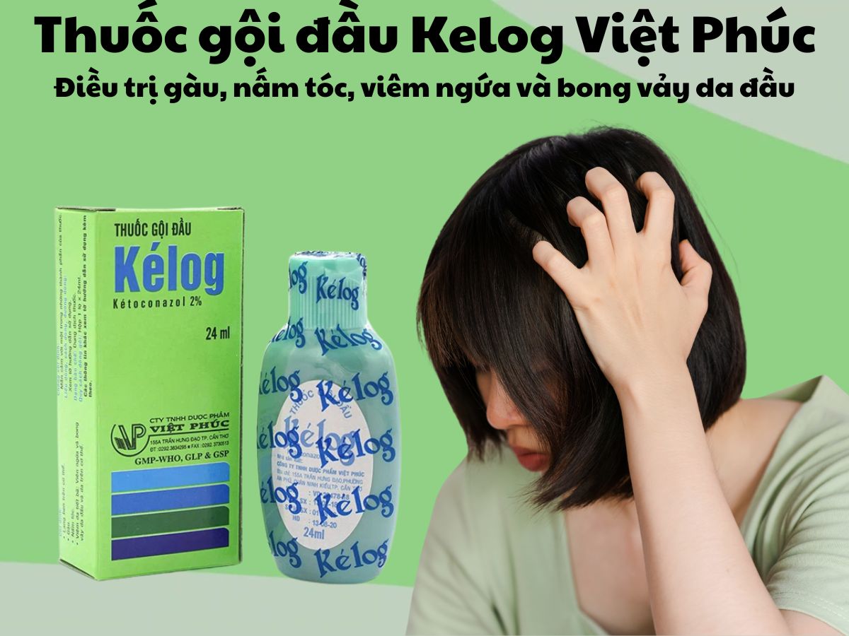 Thuốc gội đầu Kélog 24ml 11 Thuốc gội đầu Kélog 24ml - điều trị gàu, nấm tóc, viêm ngứa và bong vảy da đầu