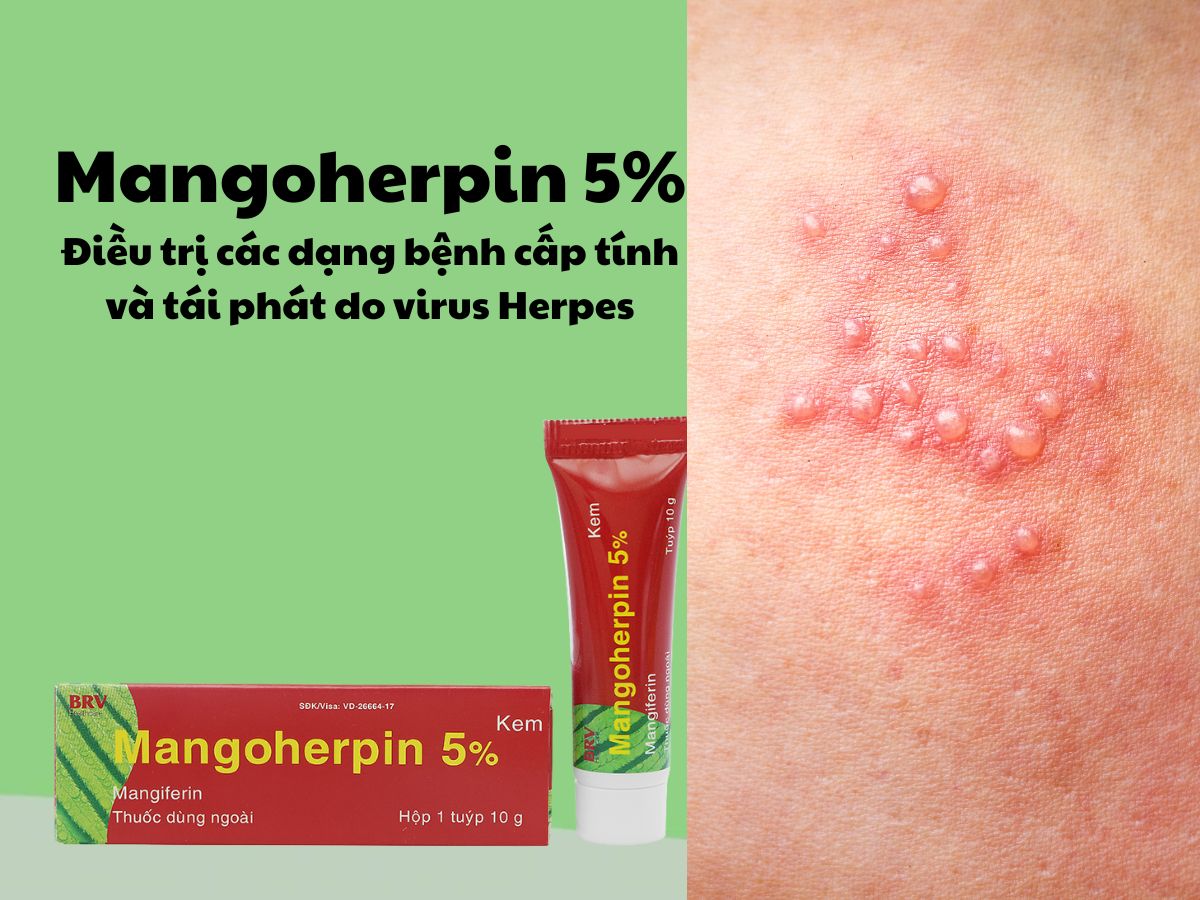 Mangoherpin 5% 12 Thuốc Mangoherpin 5% - điều trị các bệnh lý do virus herpes gây ra