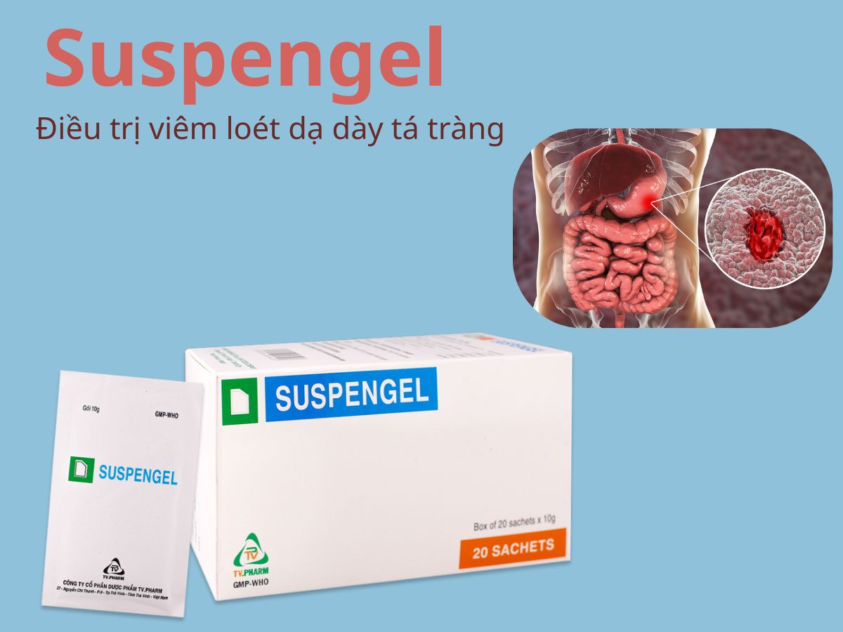 Suspengel 12 Suspengel