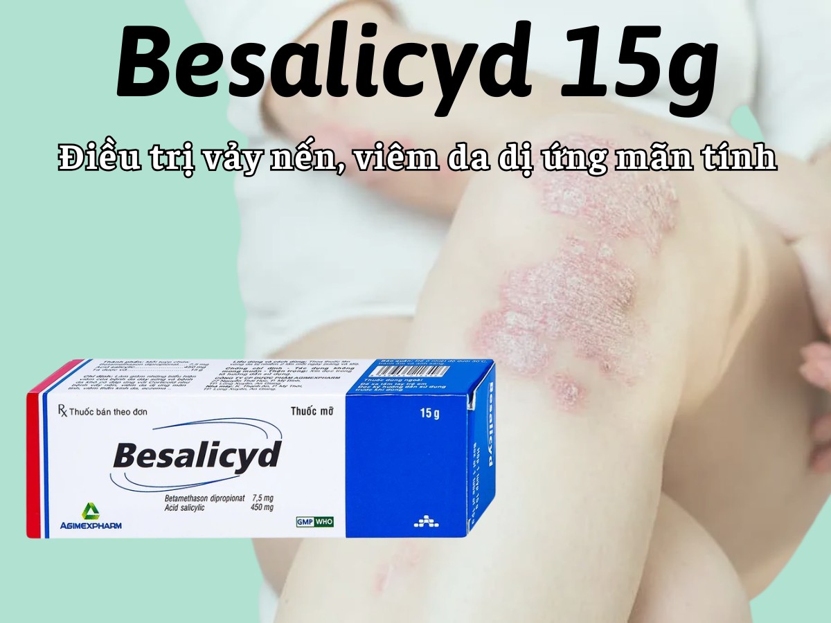 Besalicyd 15g 9 Besalicyd 15g điều trị vảy nến, viêm da dị ứng mạn tính