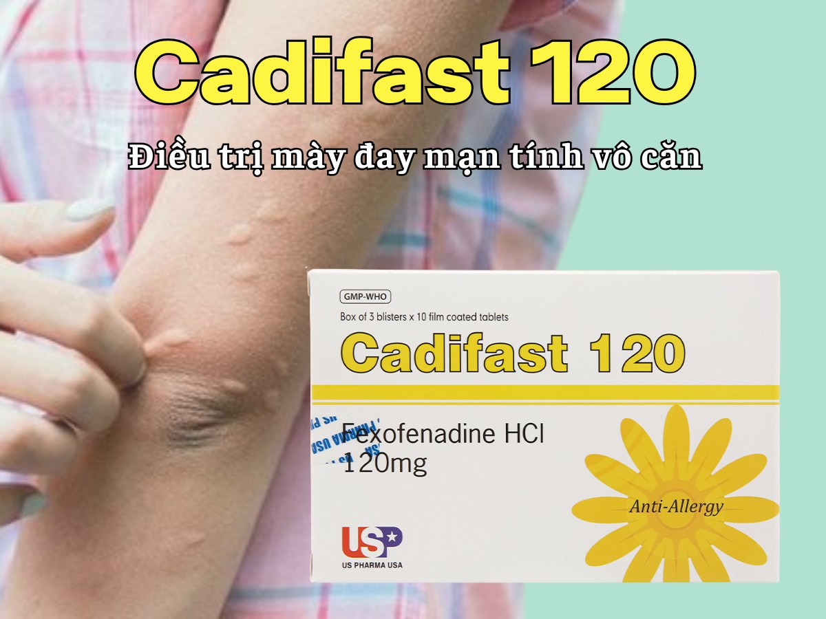 Cadifast 120 10 Cadifast 120 điều trị mày đay mạn tính vô căn