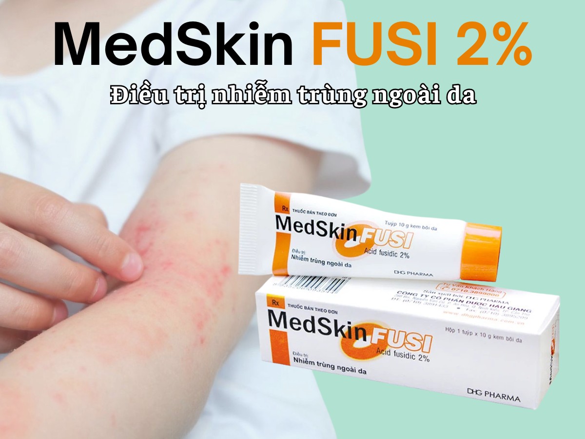 MedSkin FUSI 2% 5 MedSkin FUSI 2% điều trị nhiễm trùng ngoài da