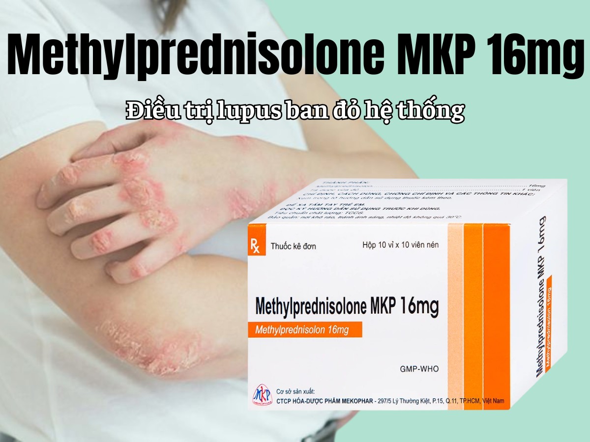 Methylprednisolone MKP 16mg điều trị lupus ban đỏ hệ thống