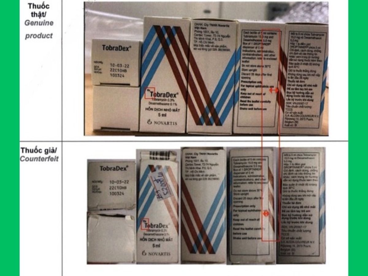 TobraDex 5ml 20 Phân biệt Hỗn dịch nhỏ mắt TobraDex thật giả
