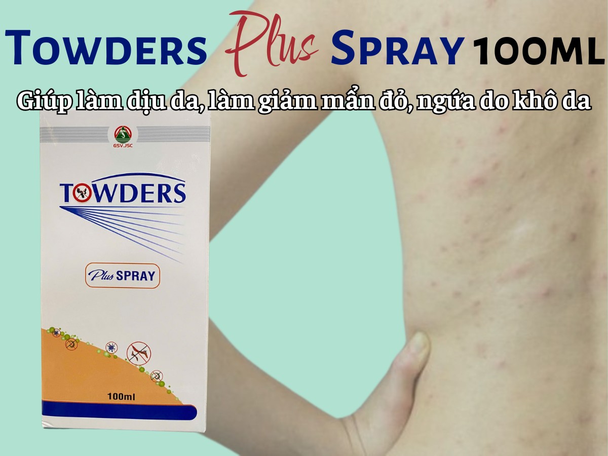 Towders Plus Spray 100ml giúp làm dịu da, làm giảm mẩn đỏ, ngứa do khô da